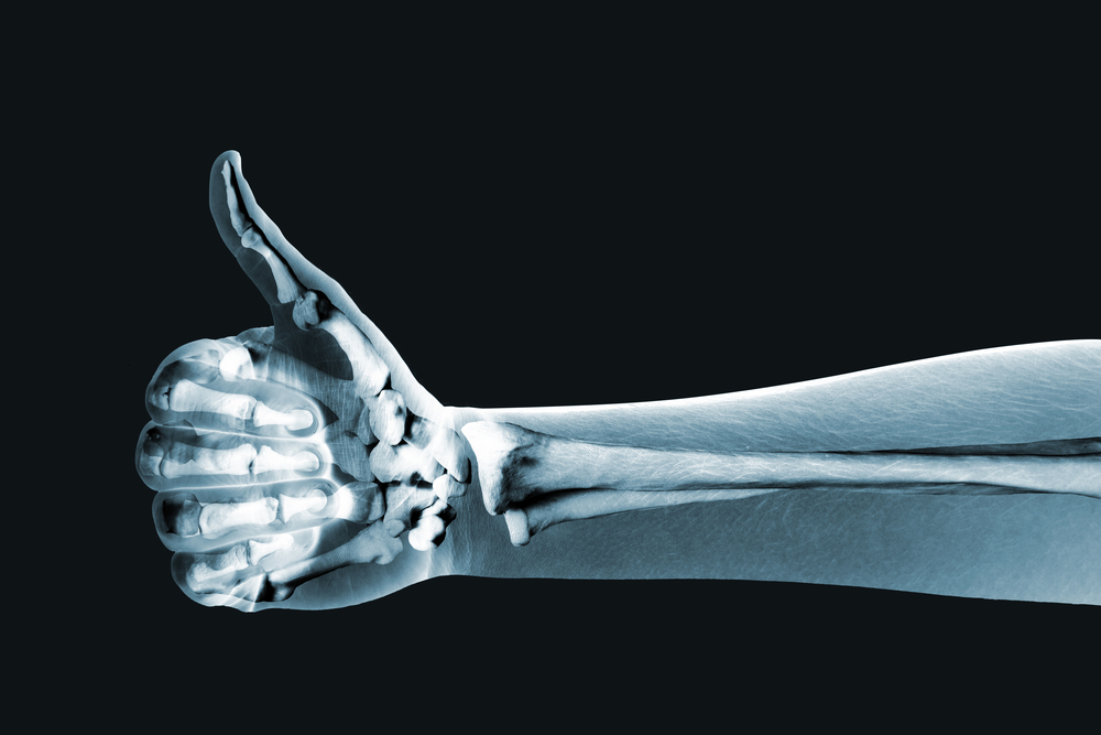 7 conseils pour avoir des os plus résistants